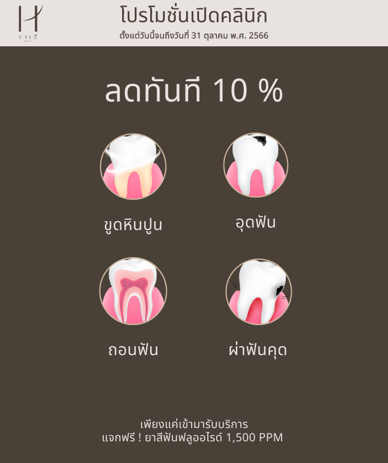 โปรโมชั่นทั่วไป